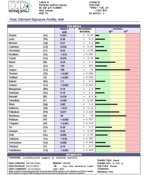 DOCTORS DATA TOXIC ELEMENTS EXPOSURE PROFILE HAIR TEST
